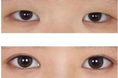 選擇合適的武漢植發(fā)醫(yī)院，看看專家排名和推薦