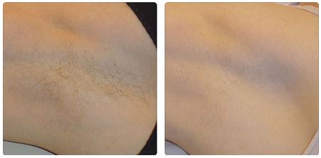 上海德琳醫(yī)療美容醫(yī)院整形價格貴嗎？王藎醫(yī)生有提供服務(wù)嗎？