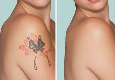 成都寶尼達(dá)授權(quán)注射醫(yī)生名錄公布  精選醫(yī)生簡介一覽