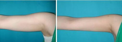 廈門(mén)美麗薇醫(yī)療美容診所值得信賴嗎？專業(yè)醫(yī)美整形機(jī)構(gòu)嗎？