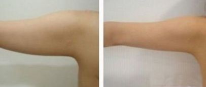 西部戰(zhàn)區(qū)一流眼科專家介紹，技術(shù)評估及收費(fèi)參考