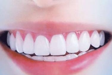 黑龍江藝星整形醫(yī)院吸脂效果如何？能否徹底消除脂肪？