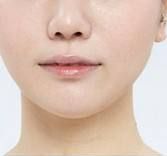 安徽省雙眼皮整形醫(yī)院，網(wǎng)友推薦熱門醫(yī)療中心排名前三