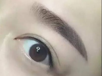 杭州整形美容醫(yī)院-網(wǎng)友贊不絕口！成就您華麗的容顏