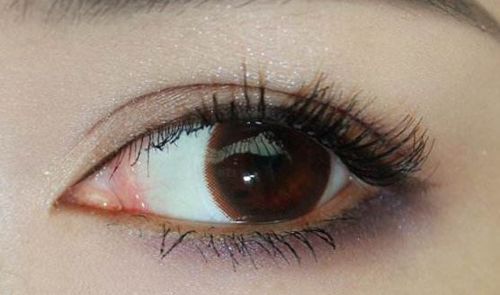 為何陳付國做隆鼻會(huì)價(jià)值不菲？一位真實(shí)案例分享揭示原因