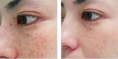 上海華美醫(yī)療美容醫(yī)院注射玻尿酸的醫(yī)生推薦，想了解一下嗎？