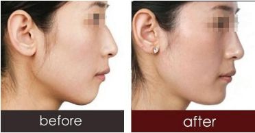 深圳哪些醫(yī)生已獲得2023年喬雅登認證？全新名單發(fā)布！