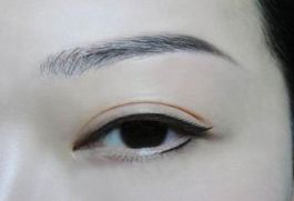 深圳著名眼袋整形專家?guī)湍獯?，鵬程醫(yī)院是否值得選擇？