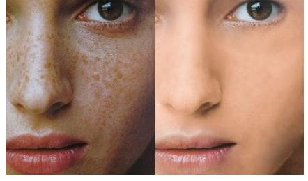 成都維度整形醫(yī)生技術(shù)點(diǎn)贊！實(shí)例曝光，周維做鼻子效果驚艷！