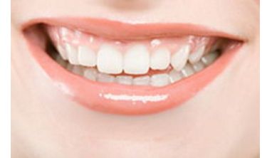 上海艾姆國際醫(yī)美整形：大腿吸脂效果案例分享及費用一覽