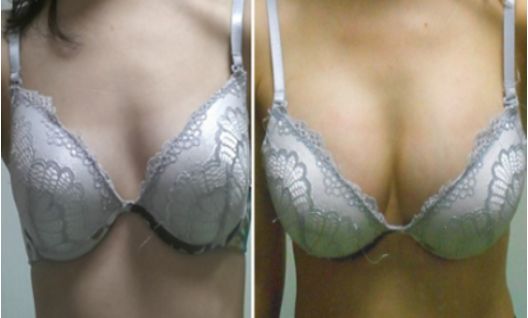 貴陽(yáng)祛眼袋：TOP醫(yī)院推薦！麗都、美貝爾、美萊等整容專家鼎力推薦！