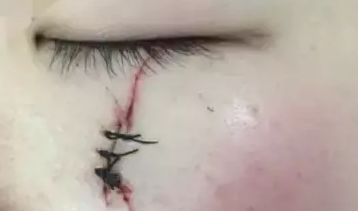 南京智美顏：了解2023吸脂案例曝光，發(fā)現(xiàn)醫(yī)療美容的驚人效果！