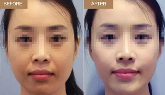 無錫市的優(yōu)秀整形美容機構排行榜，哪些醫(yī)院脫穎而出？