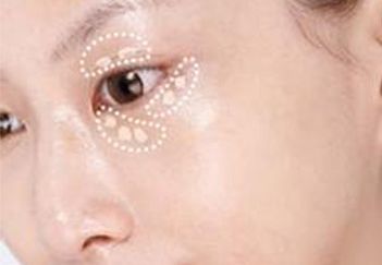 吳毅平醫(yī)生坐診醫(yī)院及隆胸案例分享，詳細(xì)介紹！