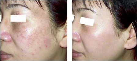 醫(yī)生付德剛面雕案例揭露！技術如何？詳細信息公布，附醫(yī)院詳解！