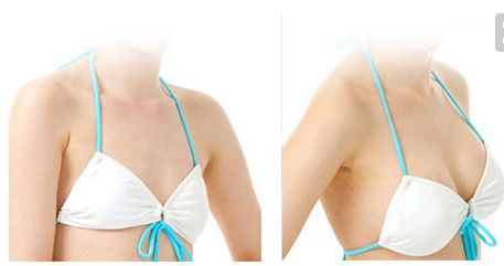 金長(zhǎng)鑫哪種技術(shù)祛眼袋效果更佳？眼袋手術(shù)最新案例解析！