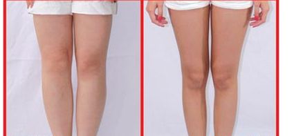 昆山人民醫(yī)院美容科提供哪些整形項(xiàng)目？著名醫(yī)師坐診+讓您雙眼煥發(fā)迷人魅力！