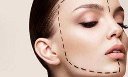 薛紅宇雙眼皮整形，獨(dú)特技術(shù)展示令人驚嘆