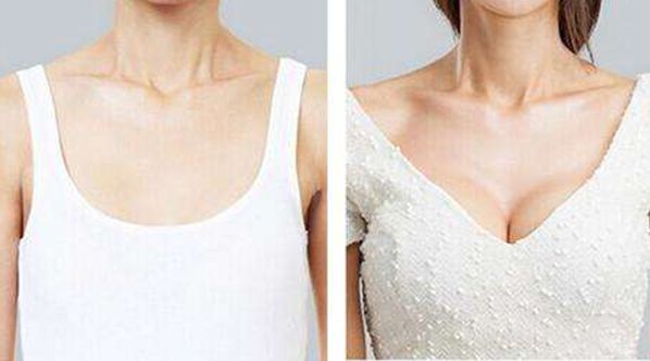 廣州割雙眼皮，哪家醫(yī)院技術(shù)高超？這幾家名聲不錯(cuò)！