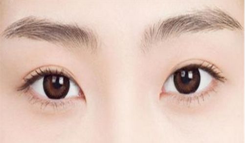 2023年廣州整形醫(yī)院首推雙眼皮修復(fù)，重磅名單揭曉！