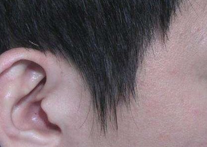 上海美容醫(yī)院盤點(diǎn)口碑排名，隆胸手術(shù)費(fèi)用公開曝光！