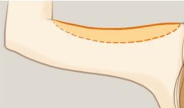 舟山市艾美醫(yī)學(xué)美容：楊誠、胡招兵醫(yī)生技術(shù)值得信賴嗎？他們的價(jià)目表如何？