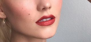 北京八大處整形外科醫(yī)生趙延勇的項(xiàng)目特長(zhǎng)及真實(shí)去眼袋案例分享