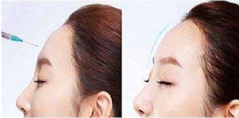 武漢雙眼皮最受歡迎的整形醫(yī)院排行榜前六！亞韓、中翰居前列為參考，看看哪家最贊！