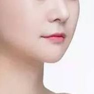 重磅推薦！全國(guó)頂級(jí)雙眼皮修復(fù)專家榜單揭曉，這四位醫(yī)師備受贊譽(yù)