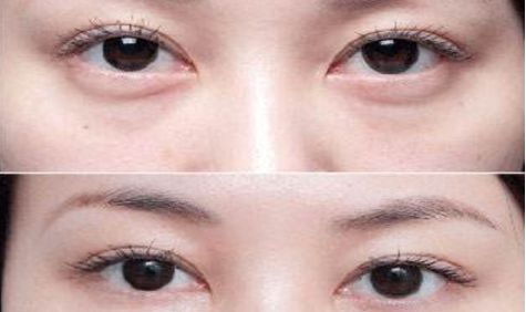 成都眼部整形醫(yī)生高分榜單發(fā)布！這些醫(yī)生哪家強(qiáng)？附詳細(xì)醫(yī)生信息