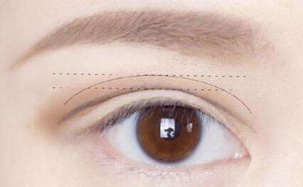 華中科技大學(xué)同濟(jì)醫(yī)學(xué)院附屬同濟(jì)醫(yī)院整形美容科：醫(yī)生技術(shù)究竟有何獨(dú)特之處？會(huì)帶來(lái)哪些效果？