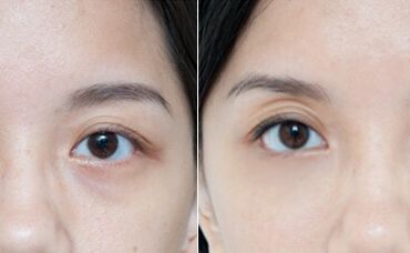 烏魯木齊子桐整形門診：了解李詠紅醫(yī)生的假體豐胸術(shù)的獨特風(fēng)格