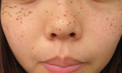 南京伊爾美醫(yī)療美容醫(yī)院真的可信嗎？有人分享他們的新醫(yī)院信息嗎？