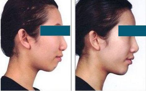 北京頂尖的整容專家排名揭曉！私人醫(yī)生榜單隆重公布