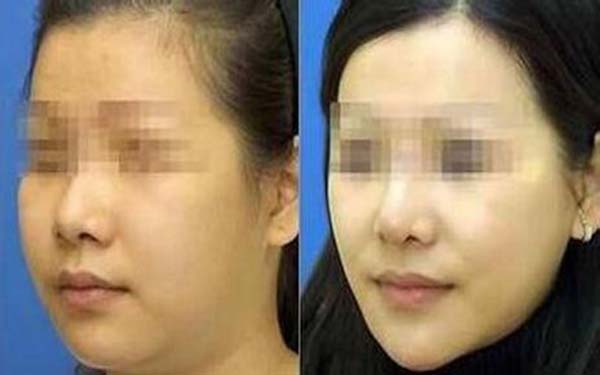 武漢至尚貝蓓好不好？2023價(jià)格表公布？興隆與變化，值得一試嗎？