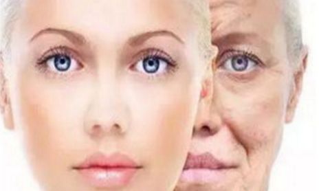 杭州藝星李斌斌如何實現(xiàn)自然雙眼皮2023年最新案例分享