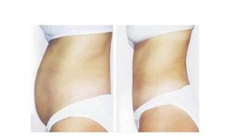 南京哪家整形醫(yī)院口碑比較好？推薦五家備受歡迎的醫(yī)院，了解詳情請(qǐng)點(diǎn)擊！