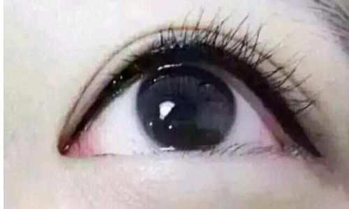 神奇！北京協(xié)和醫(yī)院的王陽醫(yī)生幫您實現(xiàn)理想吸脂效果，驚艷絕倫！