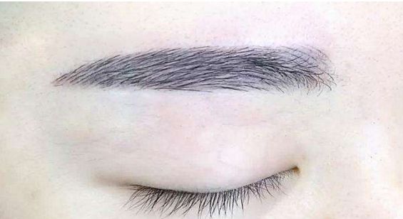 蘇州哪家醫(yī)院的拉皮除皺手術(shù)效果比較好？排名前五強(qiáng)公布