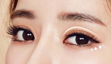 名師團隊加持，葉飛輪打造雙眼皮，成就有形雙眼美！