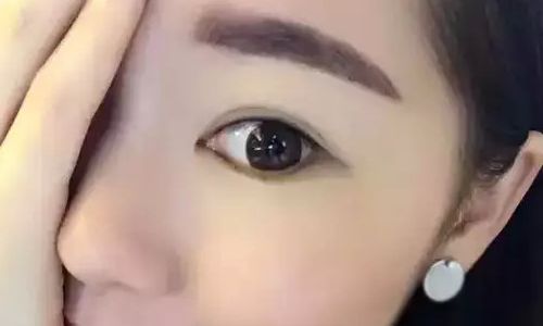 丁世凱教授：看看他的鼻子，醫(yī)生簡(jiǎn)介+案例恢復(fù)過(guò)程圖參考