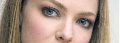 王醫(yī)生揭秘！湘雅附二實(shí)操雙眼皮術(shù)后成效公開！