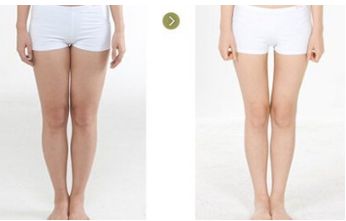 臉上的斑點：老年斑成因與斑點去除方法詳解