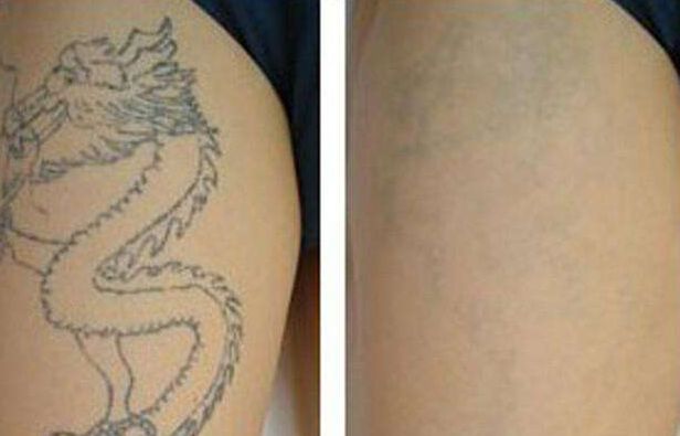 北京燒傷整形醫(yī)院排行榜：八大處、北醫(yī)三院齊名登榜