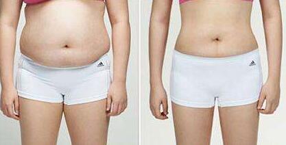 恩施奧萊做大拉皮有哪些效果？你知道嗎？