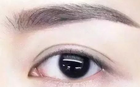 全國哪位專家值得信賴修復(fù)雙眼皮手術(shù)？頂級醫(yī)生排行榜首推名單揭曉