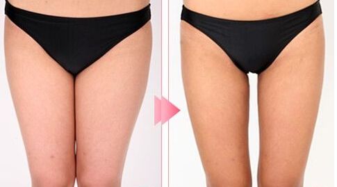 哈爾濱市十大雙眼皮整形醫(yī)生，絕對(duì)可信賴！