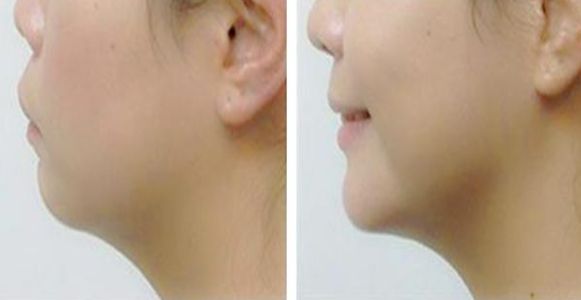 湘潭市哪家醫(yī)院擅長激光祛斑？丨激光美容科普分享