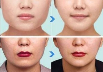 北京有哪些值得推薦的鼻整形醫(yī)生？年度五大鼻整形專家揭秘