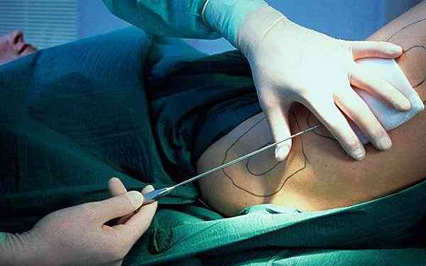 北京抽脂口碑醫(yī)院哪家好？潤(rùn)美玉之光和東方和諧的豐脂技術(shù)如何？